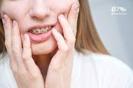 are swollen gums when in braces a bad sign