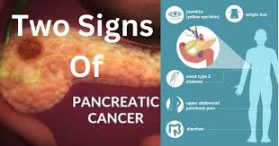 two signs of pancreatic disease at an