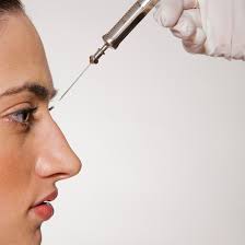 what is nonsurgical rhinoplasty risks