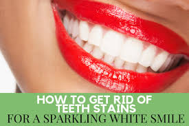 I've lived in japan over 2years and visited more than 10times before moving there. How To Get Rid Of Teeth Stains For A Sparkling White Smile