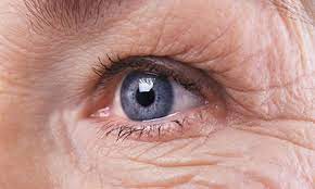 your eye after cataract surgery