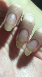 fingernails o all i hope