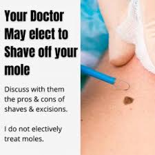 mole removal dr davin lim