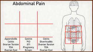 abdominal pain causes and anatomy