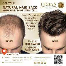 best hair root stem cell