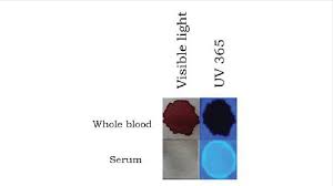 bloodstain and serum stain appearance