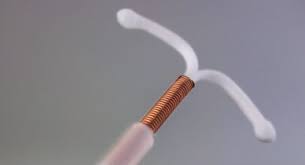 weight loss possible after iud removal