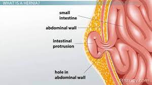 can a hernia cause testicular cancer