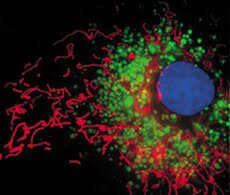 Análisis de células cancerosas | Thermo Fisher Scientific - MX