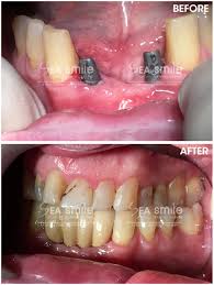 testimonials sea smile dental clinic