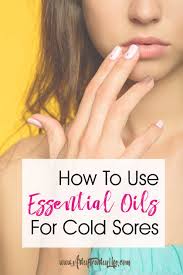 essential oils for cold sores