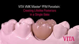 Vita Vmk Master For Full Veneering Of Metal Frameworks In