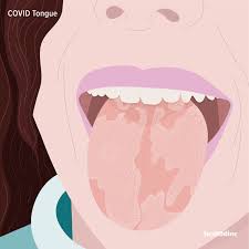 what is covid tongue and what does it