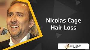 nicolas cage hair loss asli tarcan clinic