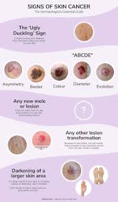 skin cancer signs symptoms the