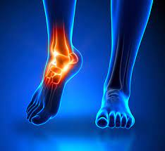 ankle pain causes treatment