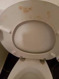 urine stained toilet seat not a sign