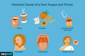 sore tongue and throat causes and