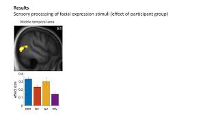 Functional Neuroanatomy Of Emotion Processing In