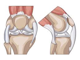 Die inneren knieschmerzen sind dann meist stechend oder auch ziehend. Stechen Im Knie Ursachen Behandlung Und Selbsthilfe Heilpraxis