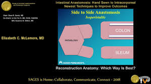 Colectomy with colocolonic, ileocolonic, or jejunocolonic anastomosis may be performed depending on the extent of the disease. Reconstruction Anatomy Which Way Is Best From The Sages Video Library