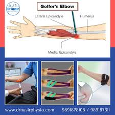 golfer s elbow treatment near me dr