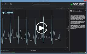 Wpf Ecg Monitor Chart Demo Fast Native Chart Controls For