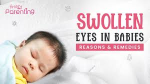 baby s eye is swollen causes treatment