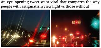 Article People Are Realizing They Have Astigmatism After
