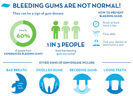 Gum disease (or gingivitis) is your own doing. Bleeding Gums Causes Treatments And Prevention Crest