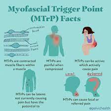myofascial trigger points facts