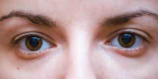 8 causes of tired eyes that have