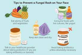 fungal rash on the face causes