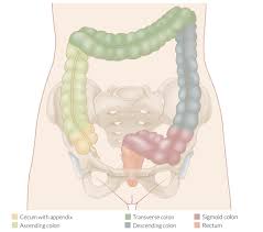 Colon cancer is the third deadliest cancer affecting both men and women in the united states. Colorectal Cancer Amboss