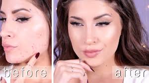 flawless skin how to cover acne make