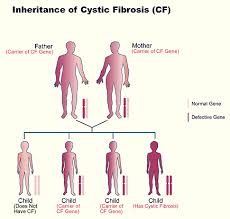 Cystic Fibrosis What Are The Chances Of A Person With