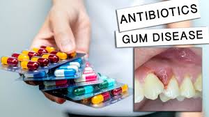 cure gum disease without a dentist