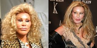 Check out plastic surgery gone wrong with before and after photos of bad celebrity plastic surgeries at womansday.com. 11 People Who Have Taken Plastic Surgery To The Extreme