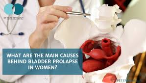 bladder prolapse in women