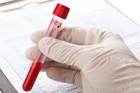 lipase why the test is ordered normal
