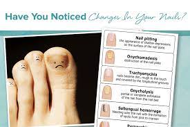 nail changes reflect your dermatologic