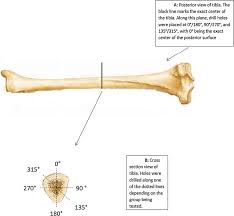Select from premium cross section of bone images of the highest quality. The Effect Of Drill Hole Location On Load Bearing Capacity Of Long Bones Abstract Europe Pmc