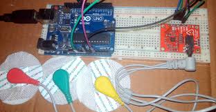 ad8232 ecg sensor arduino interfacing