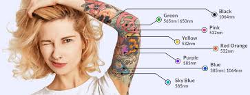 tattoo removal in tucson perfection
