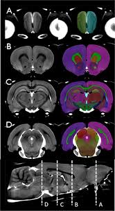 Paxinos, george, and charles watson. An Mri Derived Neuroanatomical Atlas Of The Fischer 344 Rat Brain Scientific Reports
