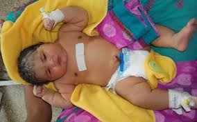 Mum Gives Birth To Heaviest Baby In India Weighing 15lb