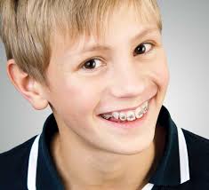 What happens at the first primary teeth are smaller in size and whiter in color than the permanent teeth that will follow. Removing Teeth For Orthodontic Treatment