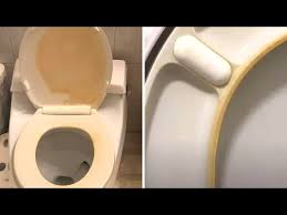 yellow stains from a toilet seat