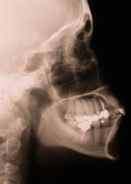 You can discuss this with your dentist or there is no actual average cost for small business insurance. Dental X Ray Cost How Much Are Dental X Rays Without Insurance