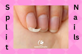 mastering nail split repairs